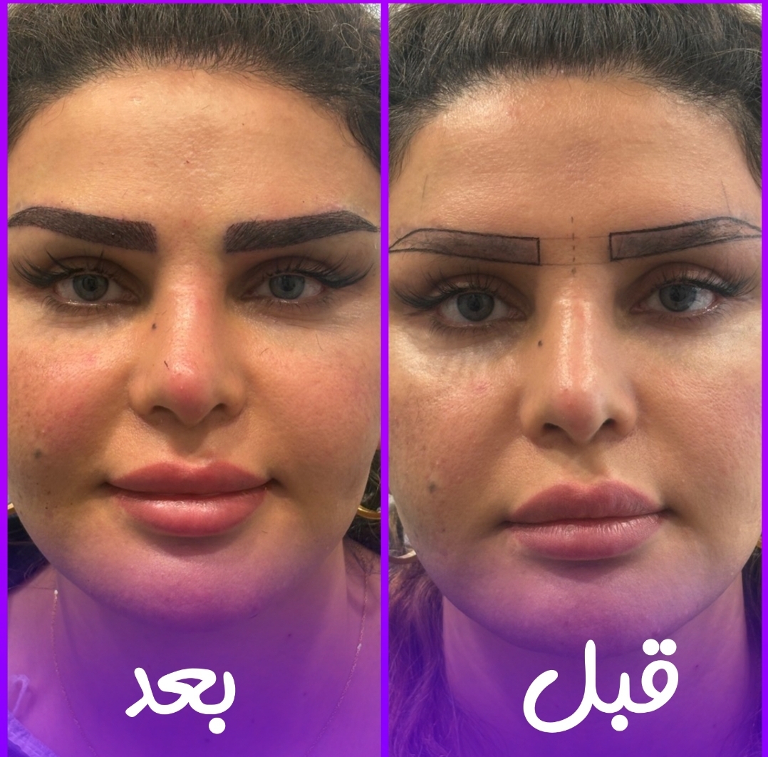 کاشت‌ابرو طبیعی‌کرج