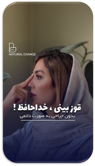 تیپ پلاستی بینی در تهران