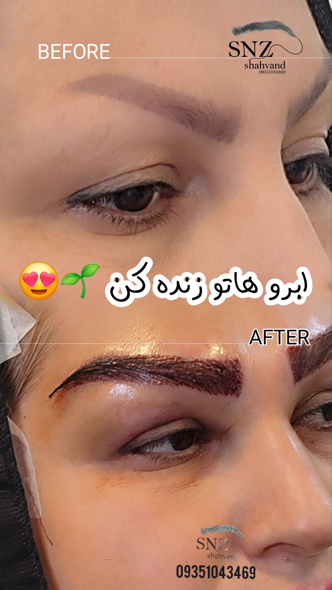 کاشت ابرو در شیراز