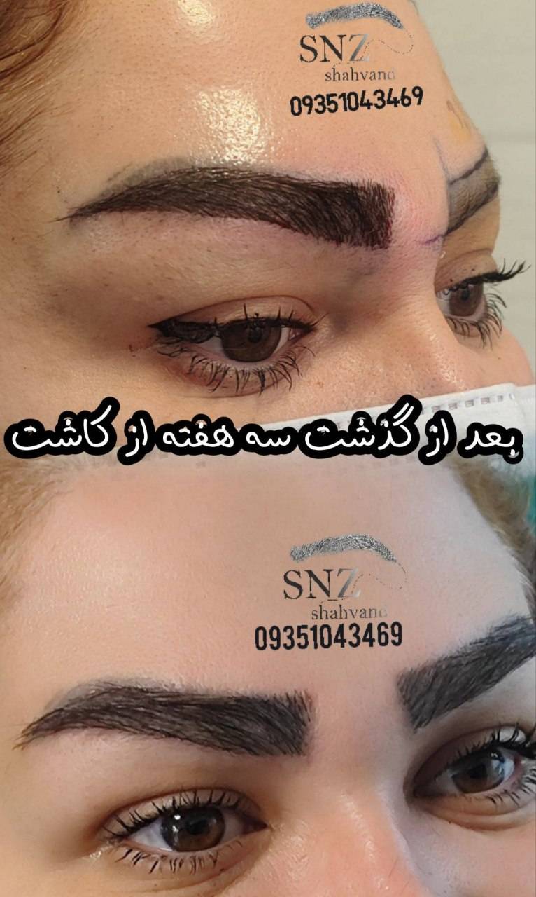 مجموغه ساناز شهوند