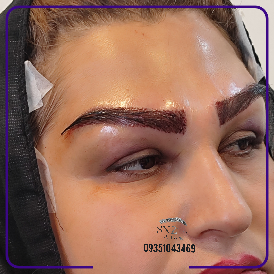 کاشت ابرو خواب طبیعی دراصفهان