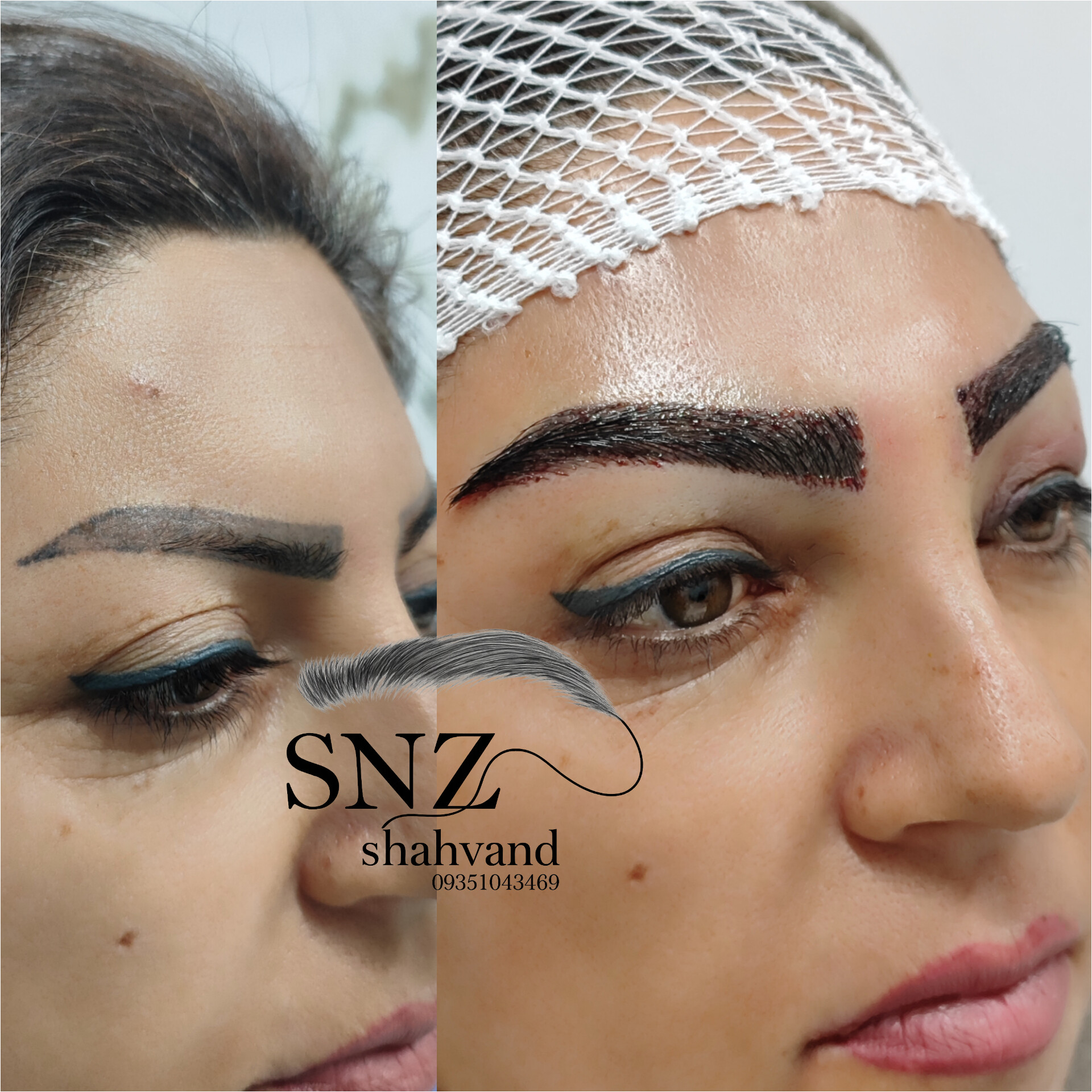 کاشت مو اقساطی در اصفهان