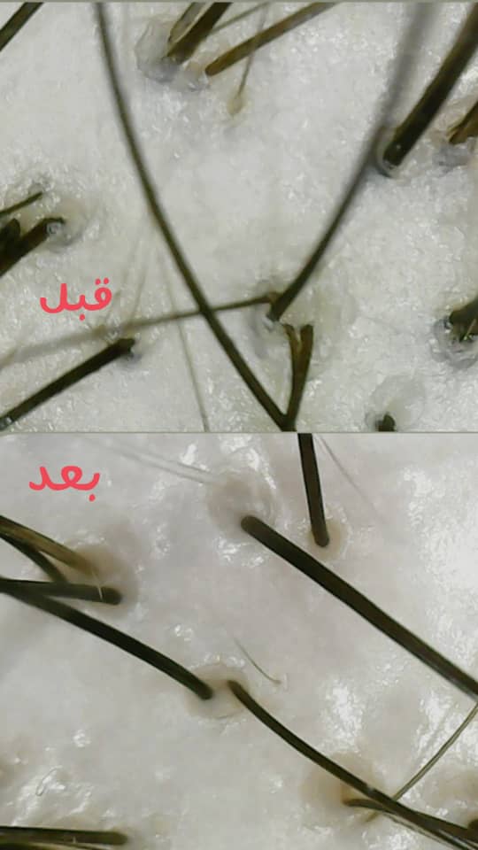 فر دائم مو در خمینی شهر 