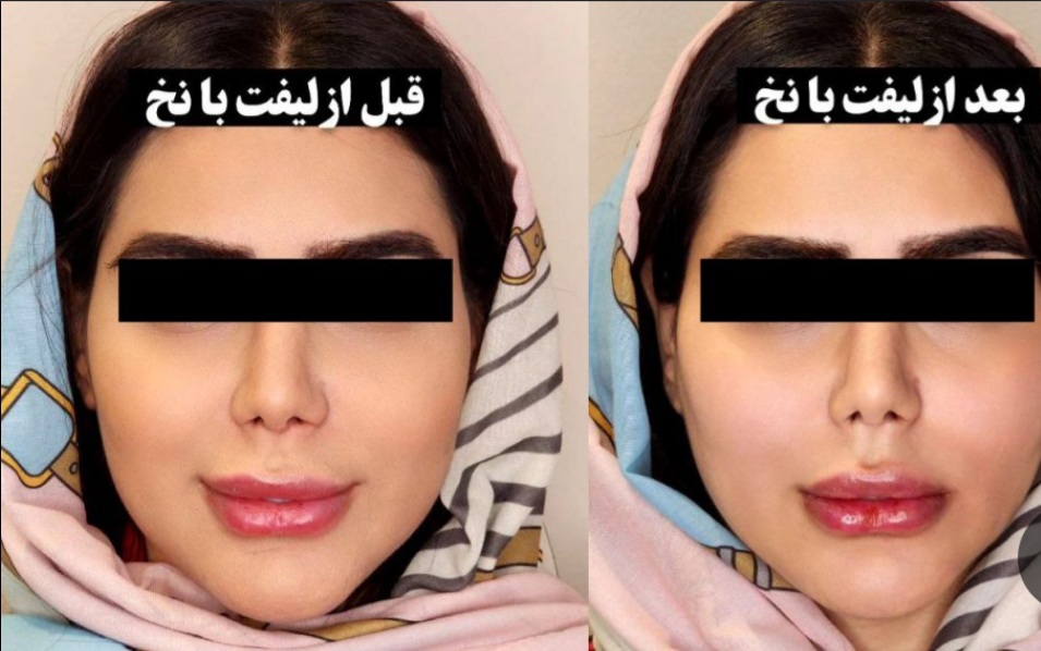 مرکز تخصصی زیبایی در مشهد

