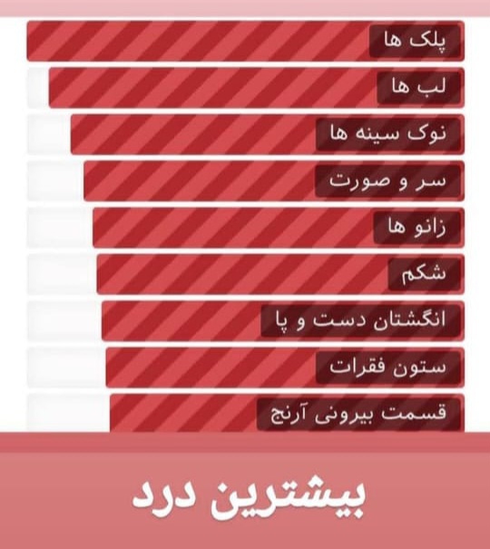 ترمیم تتوهای قدیمی در اصفهان