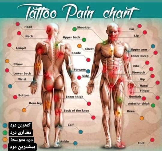 پاک کردن تتو در اصفهان