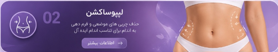 دکتربابایی متخصص عمل بینی گوشتی در اصفهان