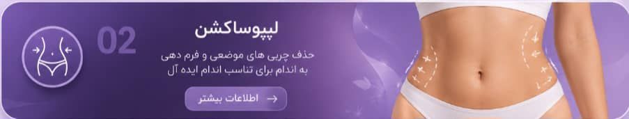 دکتر عمل بینی استخوانی دراصفهان