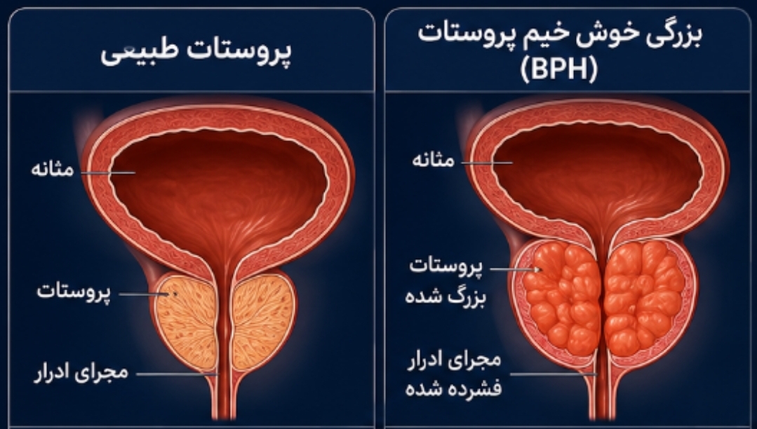 متخصص و جراح ارولوژی در کرج&nbsp;