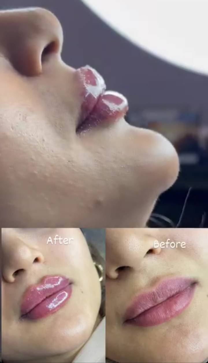 بهترین کلینیک زیبایی در فولادشهر