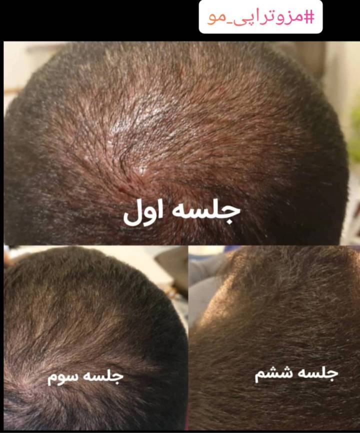 بهترین کلینیک زیبایی در فولادشهر