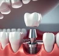 کلینیک دندانپزشکی در هشتگرد