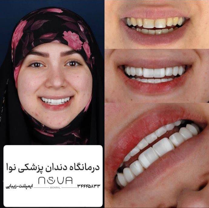 دندان پزشکی در تبریز