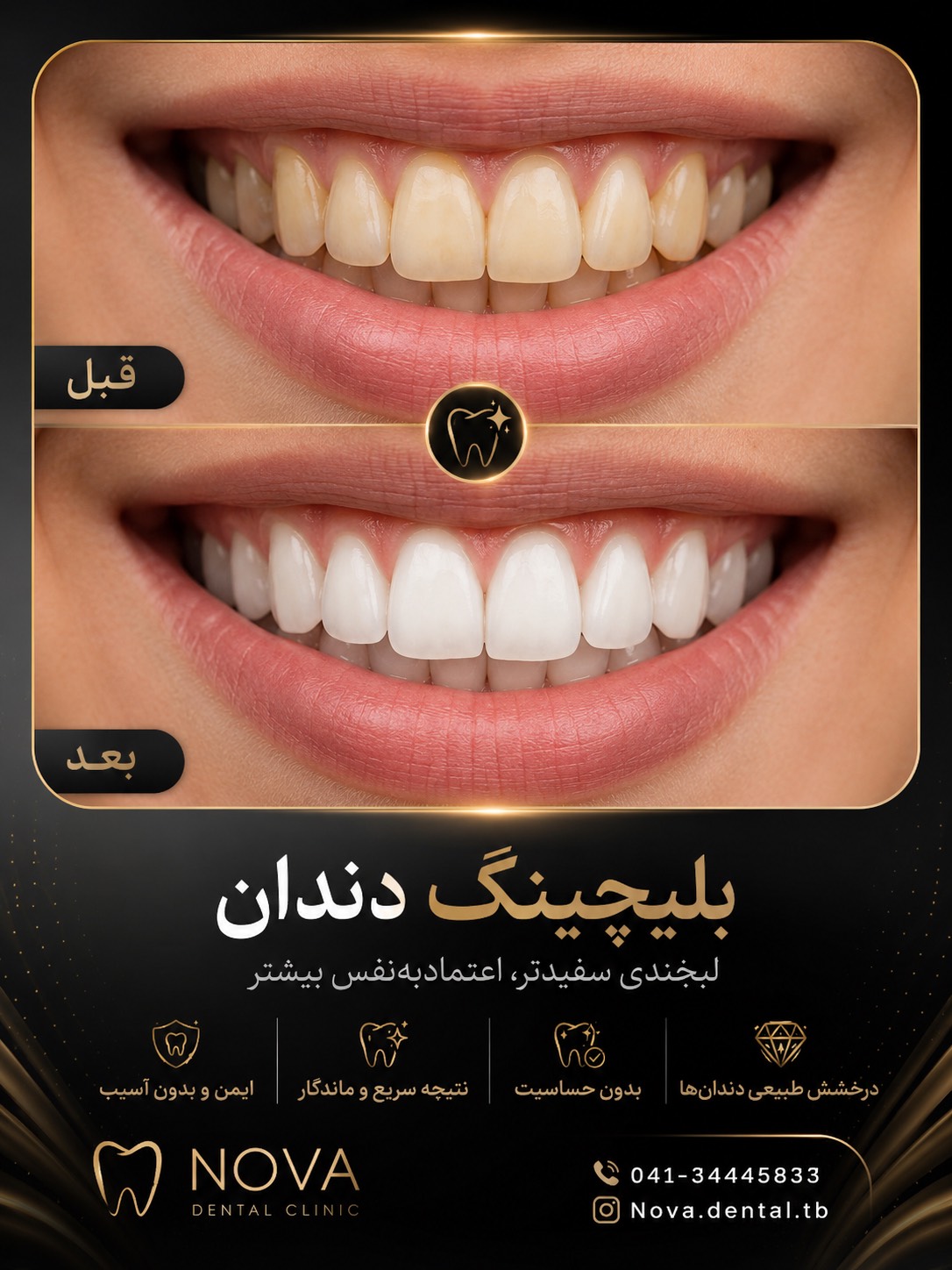 دندون پزشک حرفه ایی در تبریز