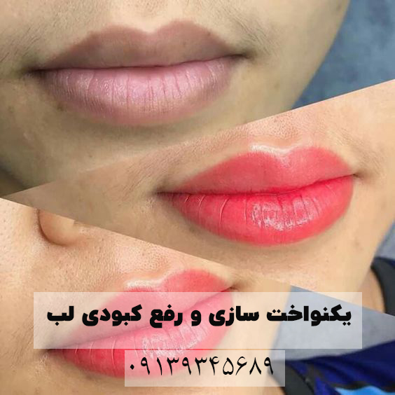 میکرو ابرو در اصفهان 