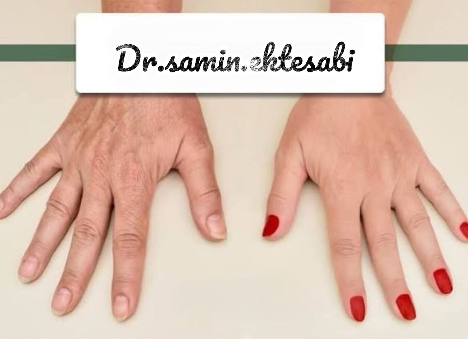 نمونه کار کانتورینگ فول فیس و فیلر بادی شیراز