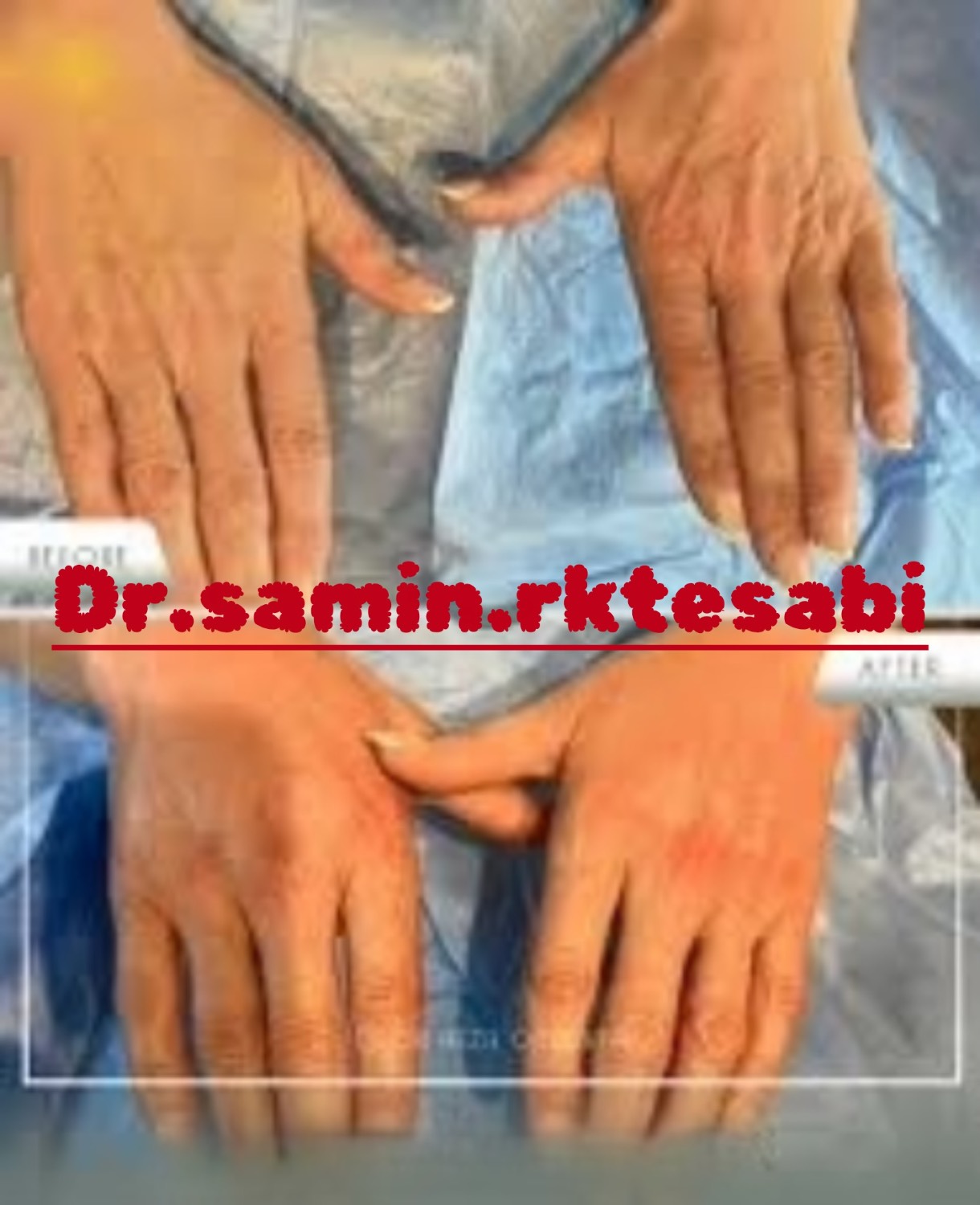 نمونه کار کانتورینگ فول فیس و فیلر بادی شیراز