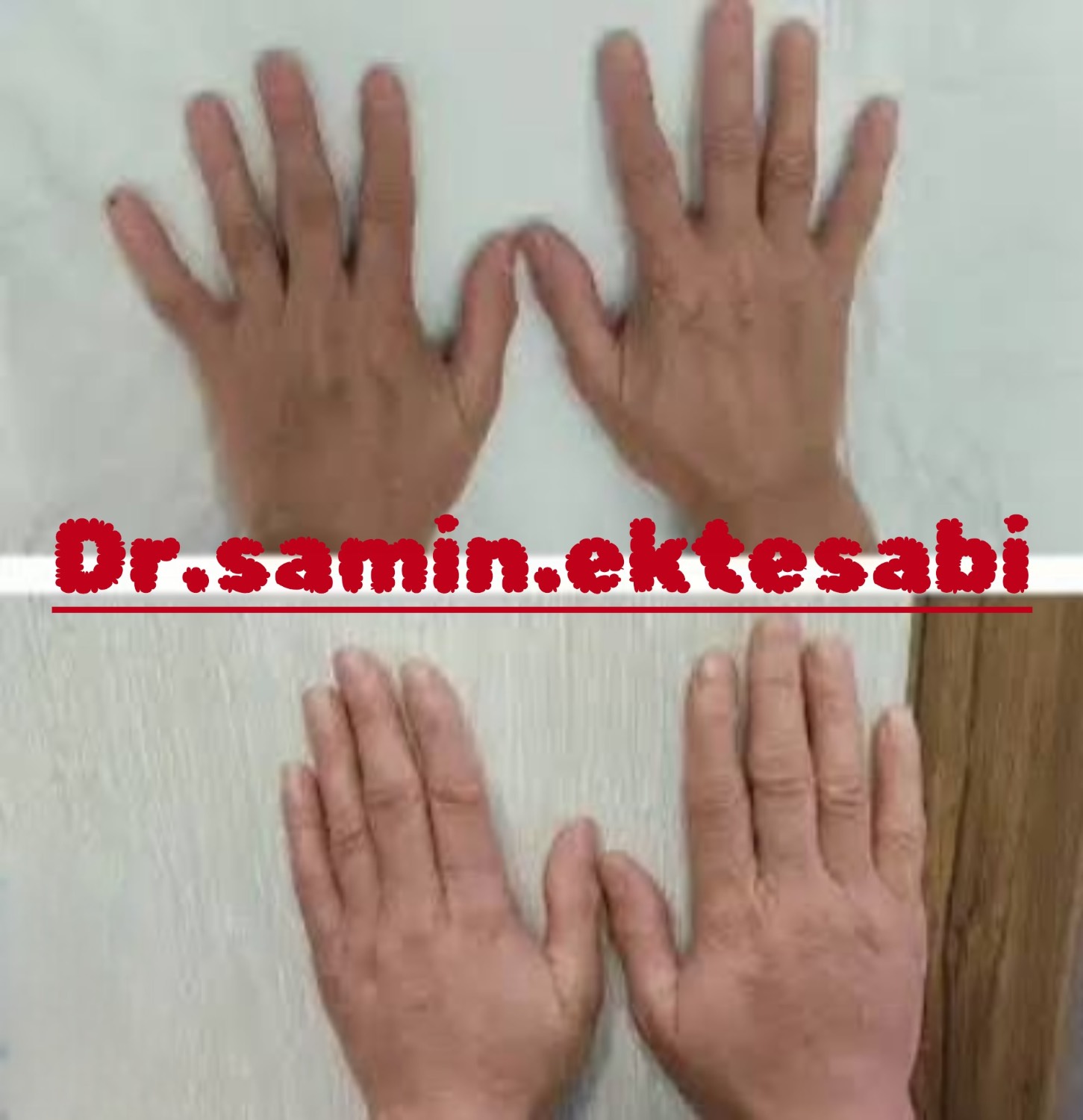 نمونه کار کانتورینگ فول فیس و فیلر بادی شیراز