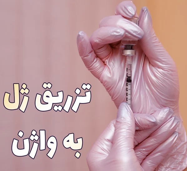 نمونه کار فیلر بادی شیراز
