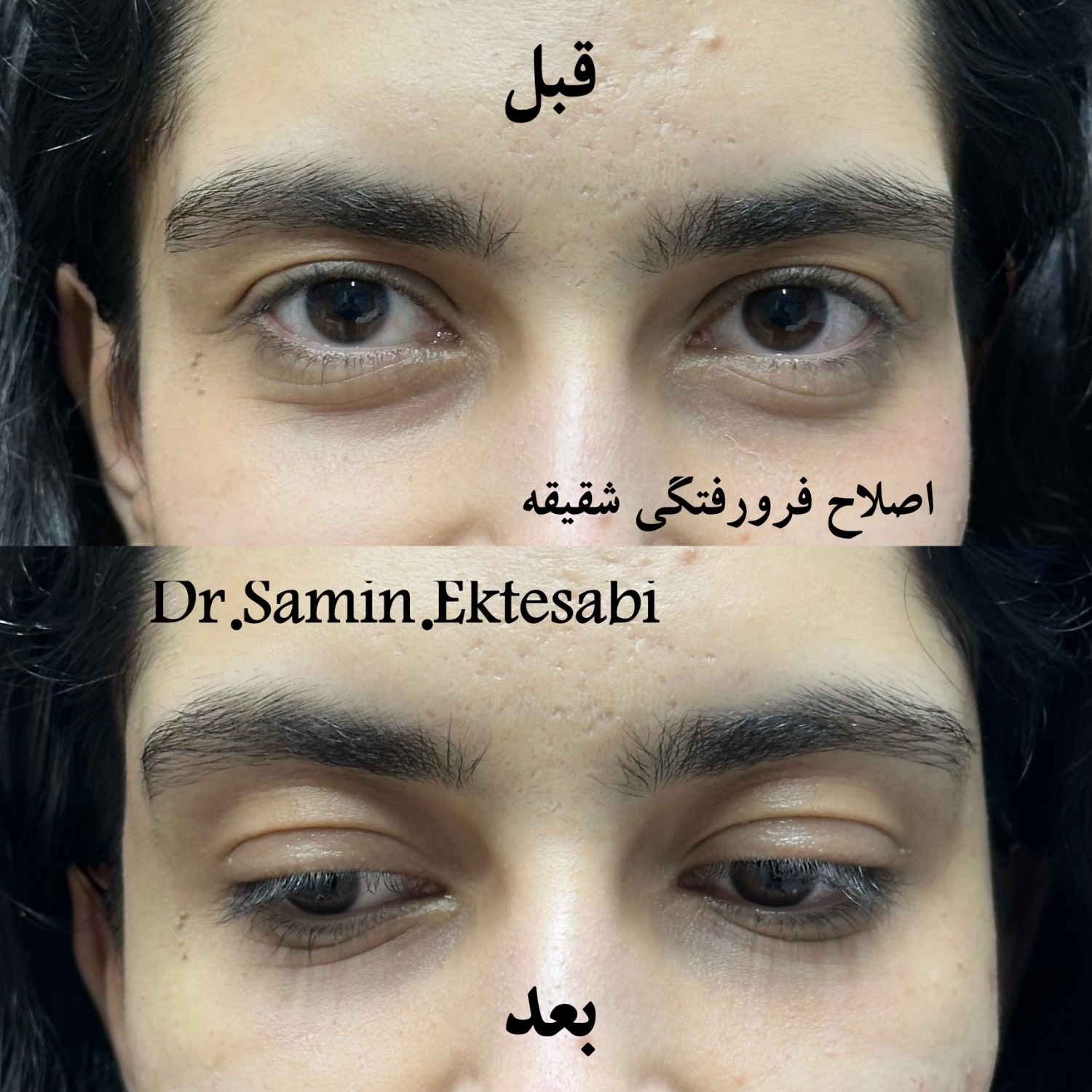 نمونه کار فیلر بادی شیراز