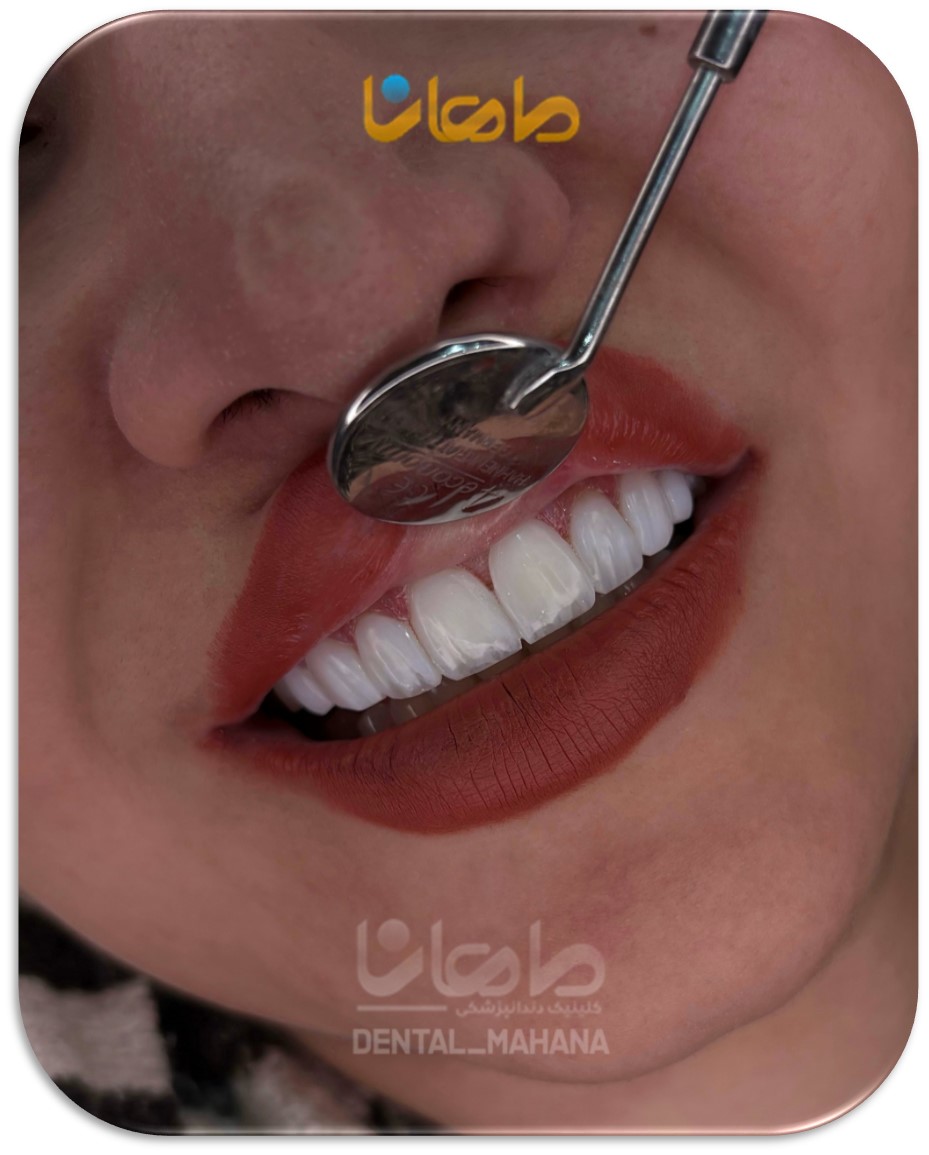 بهترین دندانپزشکی زیبایی کرج