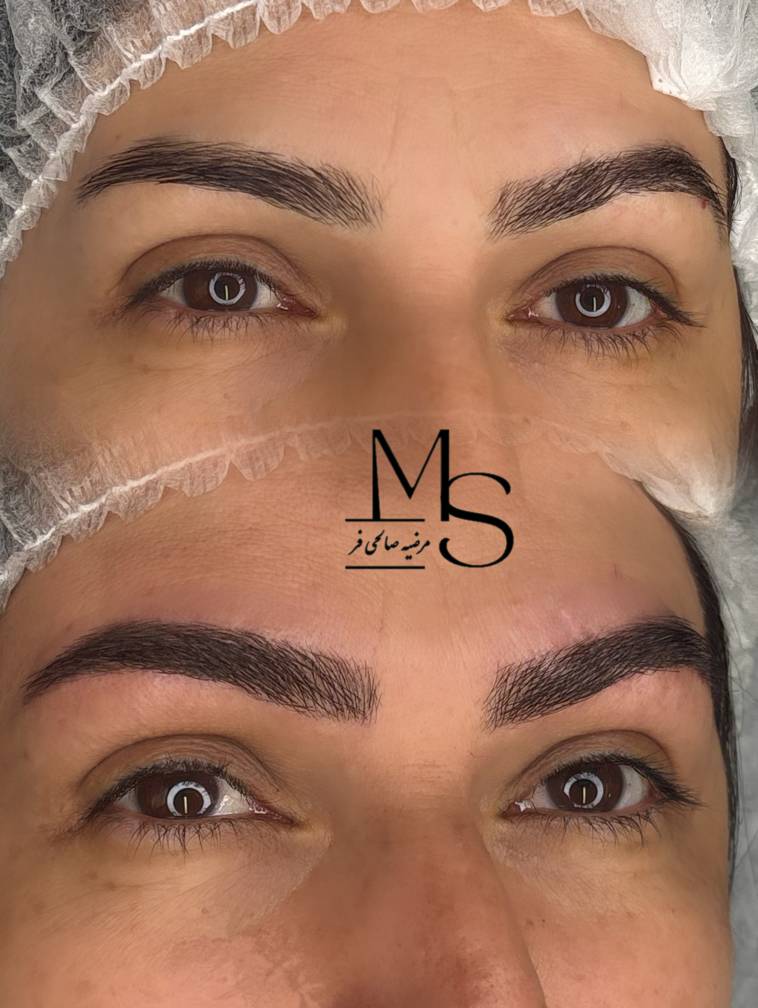 نمونه کار تراکم خطوط ابرو مرضیه صالحی‌فر