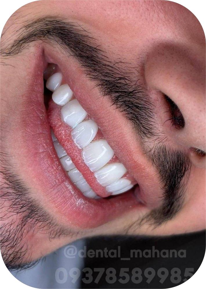 دندانپزشک زیبایی