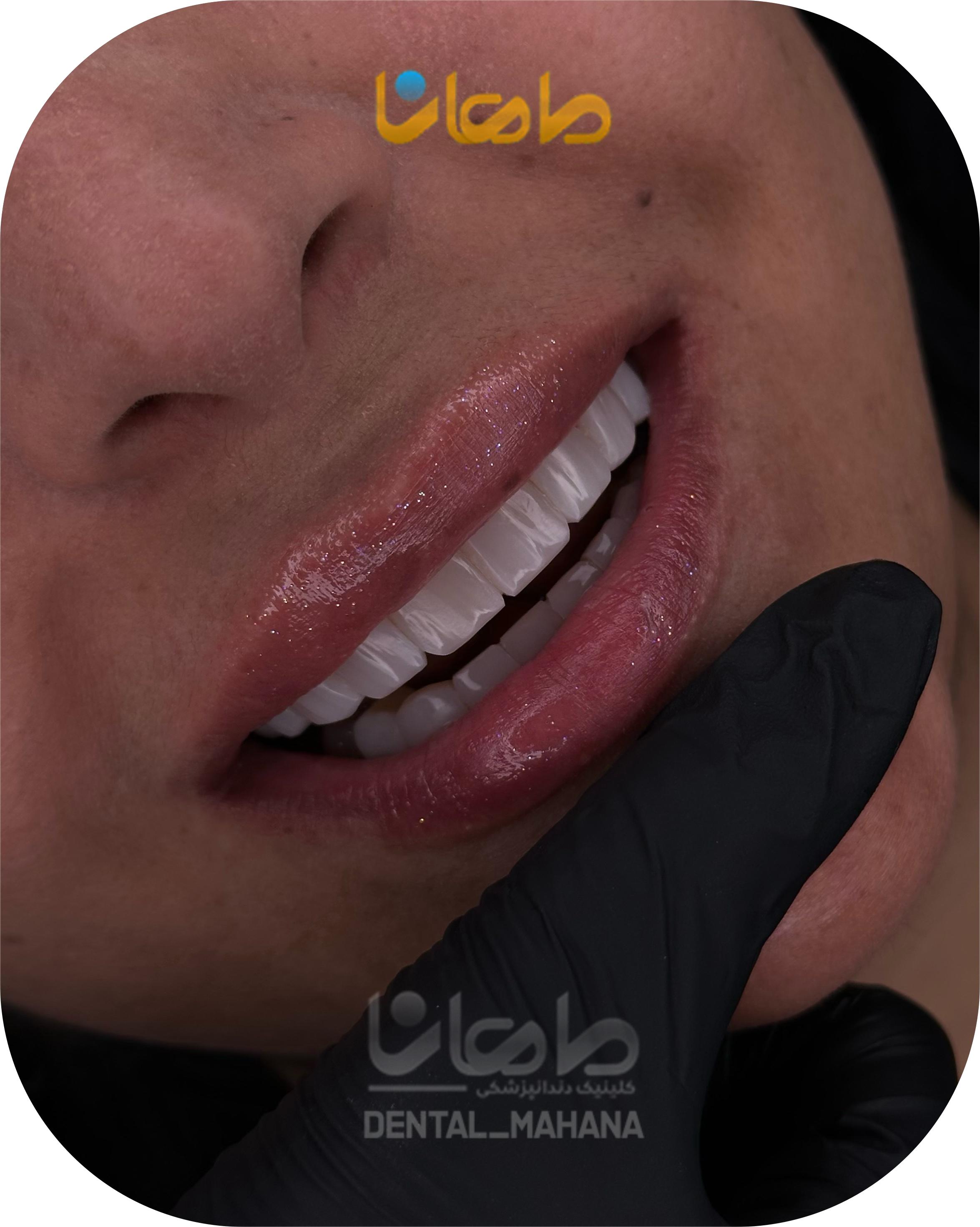 خدمات دندانپزشکی زیبایی