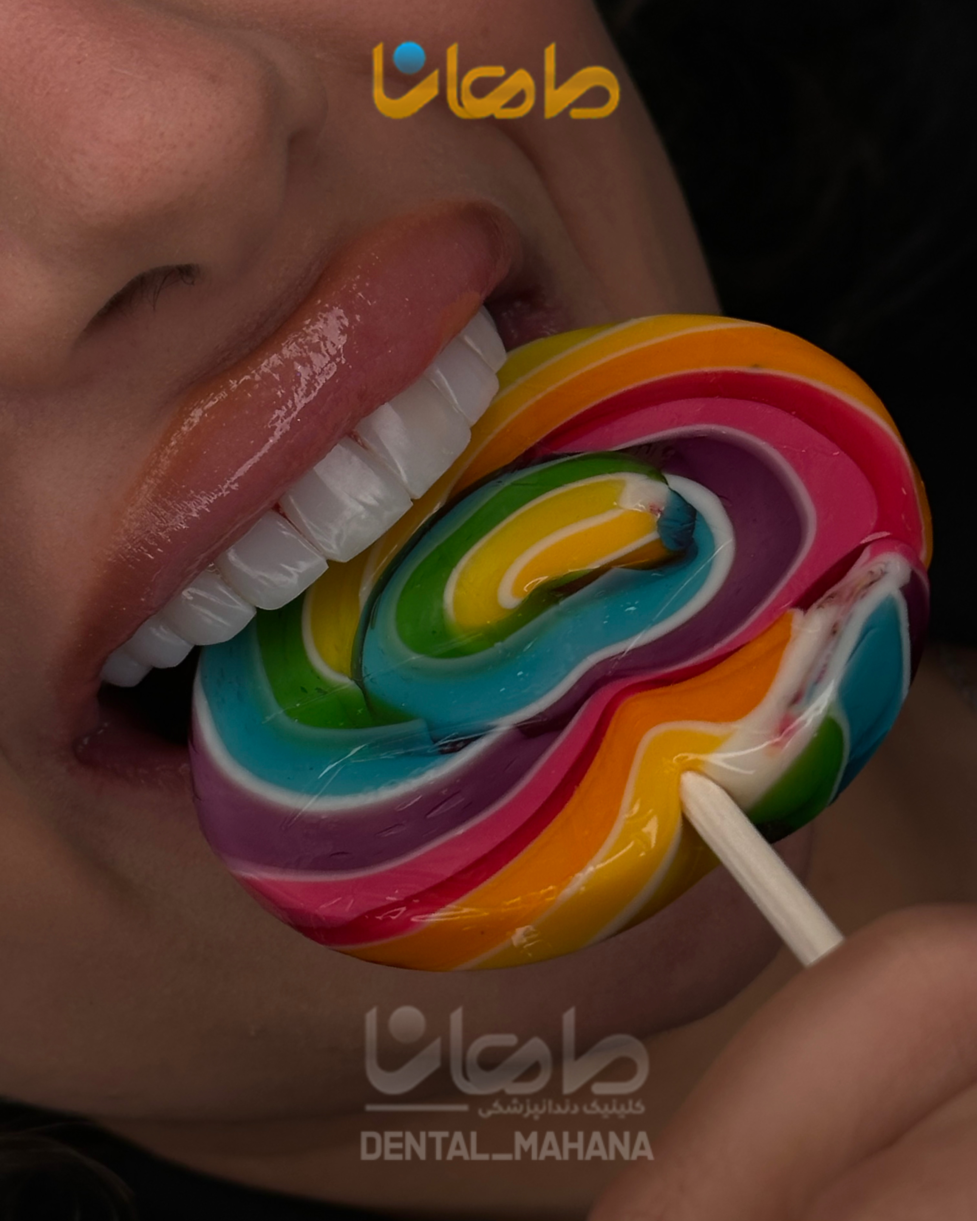 طراحی لبخند و انتخاب رنگ کامپوزیت دندان در عظیمیه - کلینیک ماهانا
