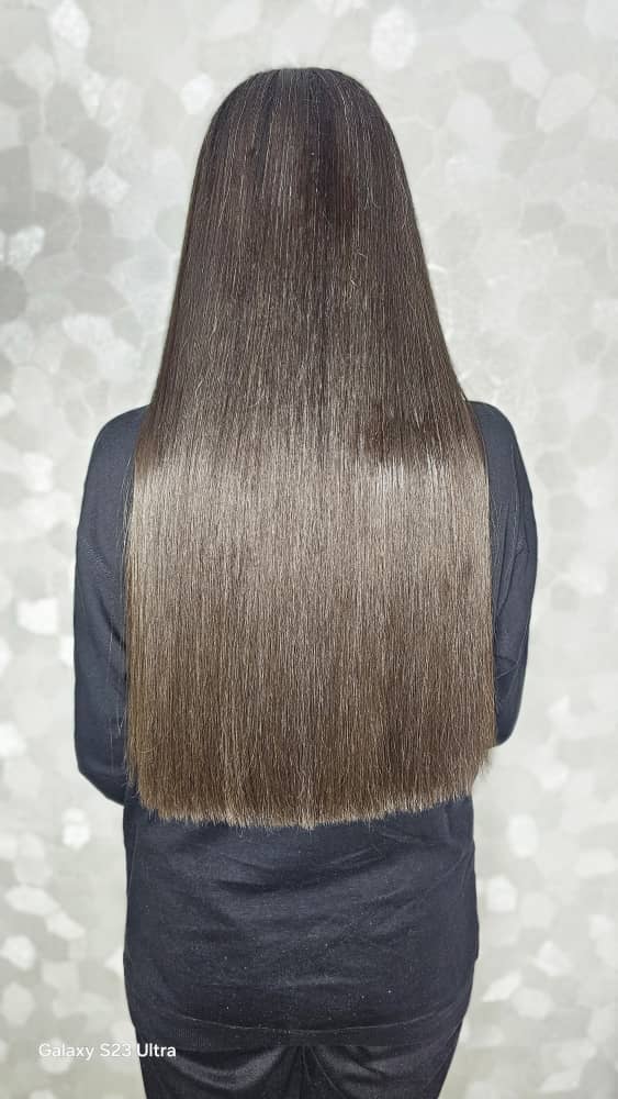نمونه کار احیای مو در اصفهان