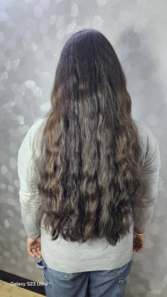 نمونه کار احیای مو در اصفهان