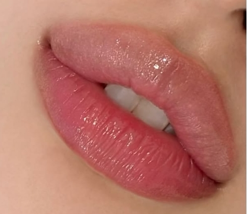 تزريق ژل و بوتاکس در نارمک&nbsp;
