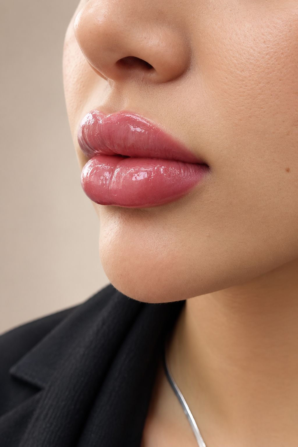 تزريق ژل و بوتاکس در نارمک&nbsp;