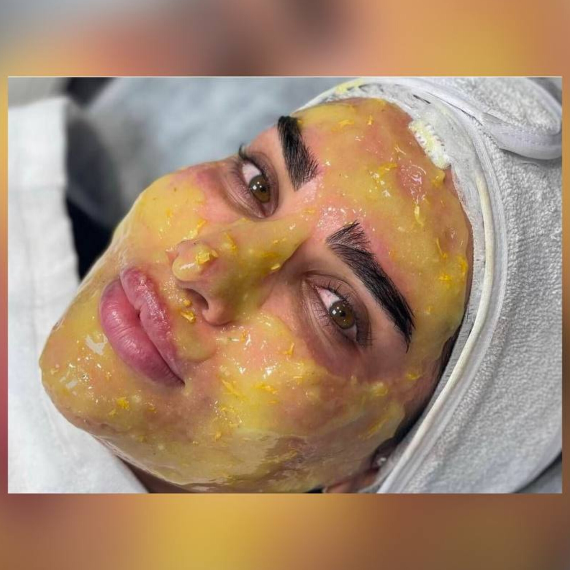 نمونه خدمات پوست سالن زیبایی سیملی
