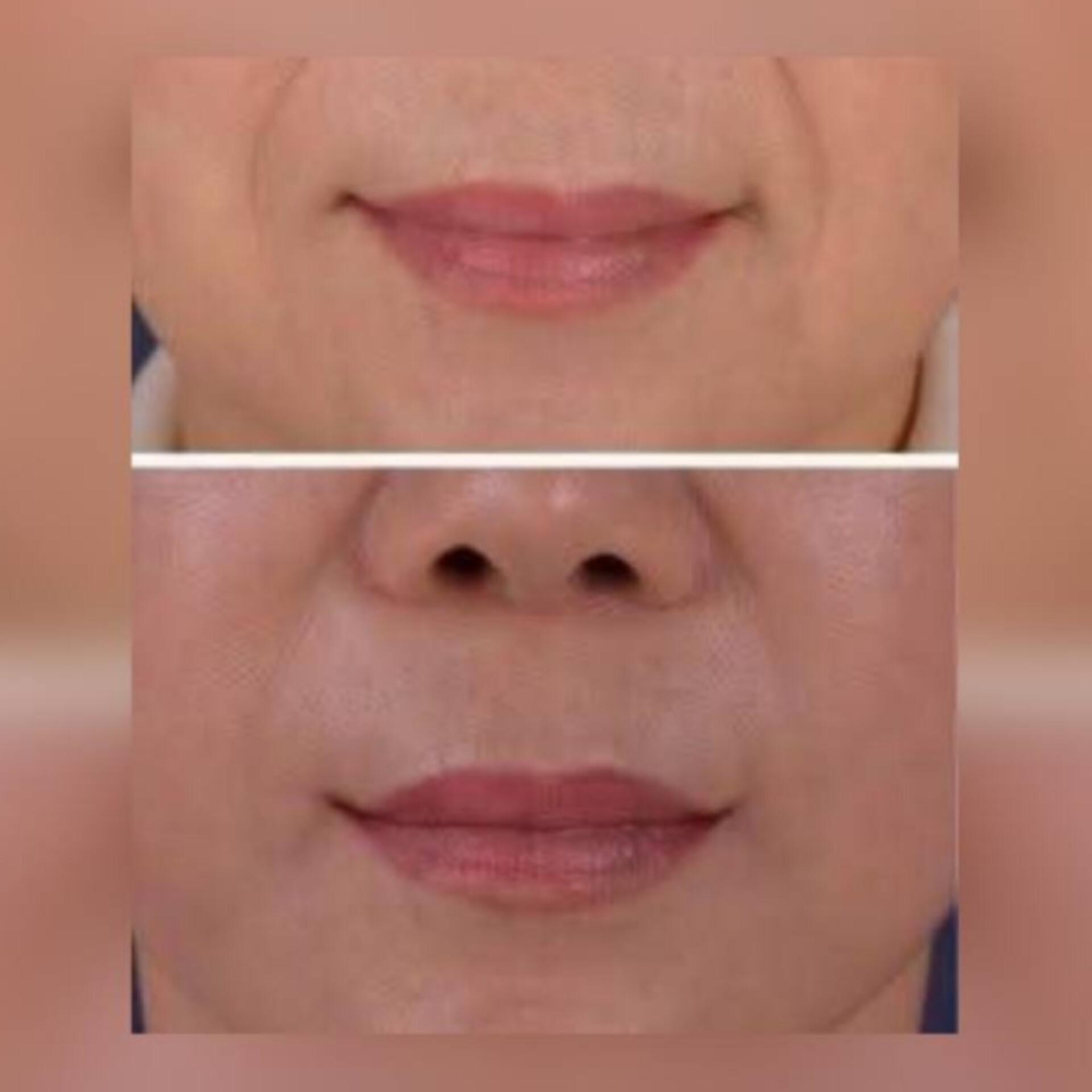 نمونه خدمات زیبایی پزشکی در تهرانپارس