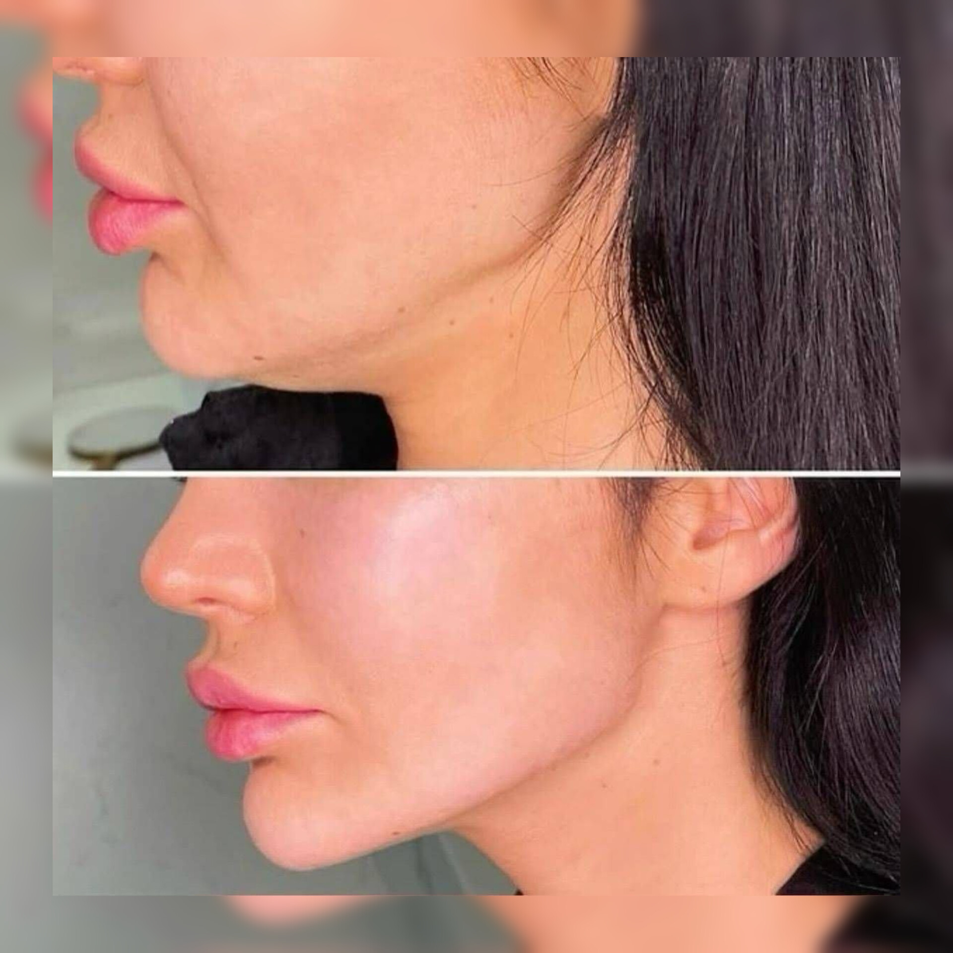 نمونه خدمات زیبایی توسط پزشک در سالن سیملی