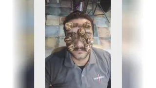 حلزون تراپی