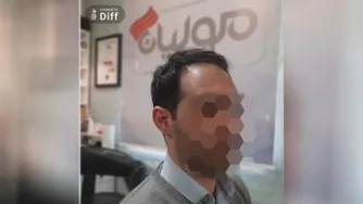 پروتز مو