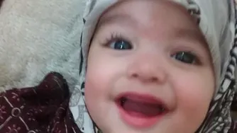 تزئین میوه