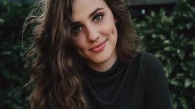 چال گونه ارون افشار