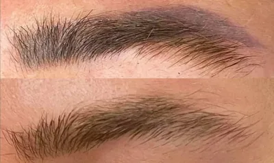 مرکز لیزر تاتو در تبریز