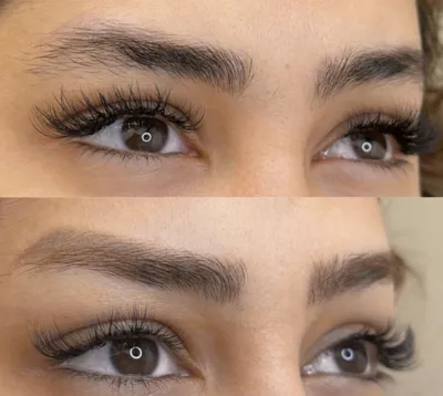 بهترین مرکز لیزر تاتو در تبریز