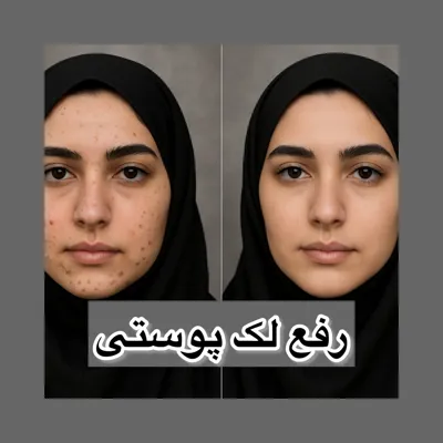 مرکز لیزر تاتو در تبریز