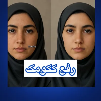 مرکز لیزر تاتو در تبریز