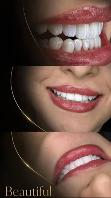 لبخند رویایی نزدیک تر از همیشه
این لبخند مثل الماس درخشش داره&nbsp;