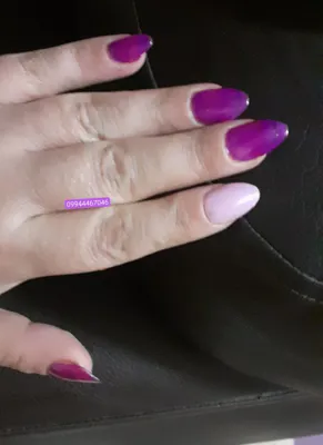کاشت ژل