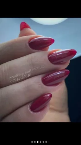 کاشت سالنی میندال&nbsp;