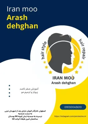 پروتز مو نجف آباد