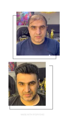 آموزش پروتز مو در نجف آباد