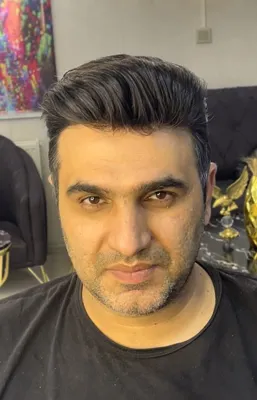 پروتز مو در نجف آباد